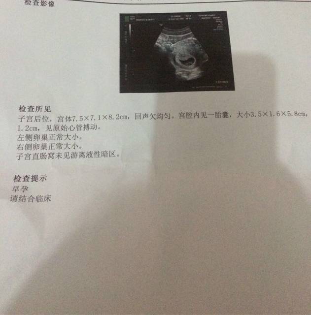 西安正规代怀地址,守护家庭的幸福