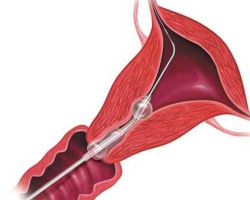 南京职业助孕女孩,试管婴儿医院全国排行