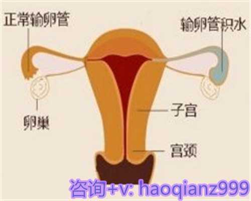 合肥正规三甲医院供卵,用生命谱写新的篇章,让幸福永远绽放